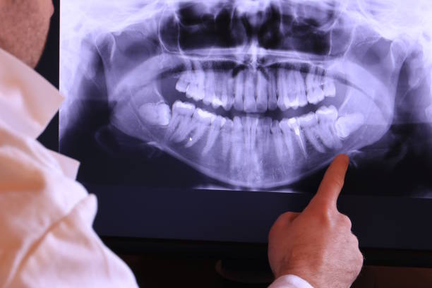 Best Broken or Cracked Tooth Emergency Dentist in Gresham Park, GA